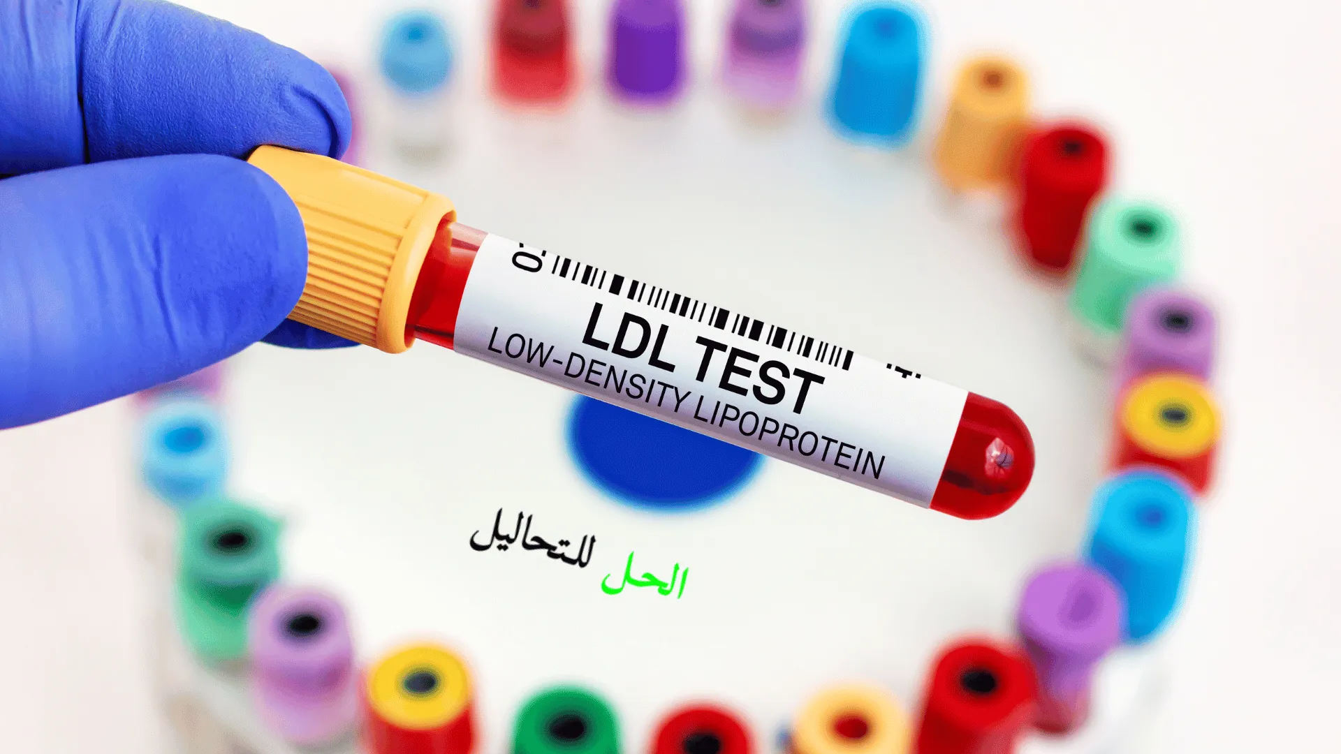 انواع تحاليل الدم في الجسم 